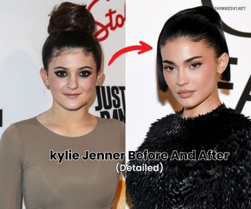 Kylie Jenner Before And After